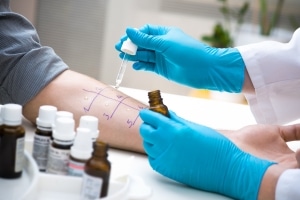 Medical professional performing an allergy test